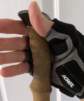 Hiking Gloves for Dupuytren's contracture - Backpacking Light