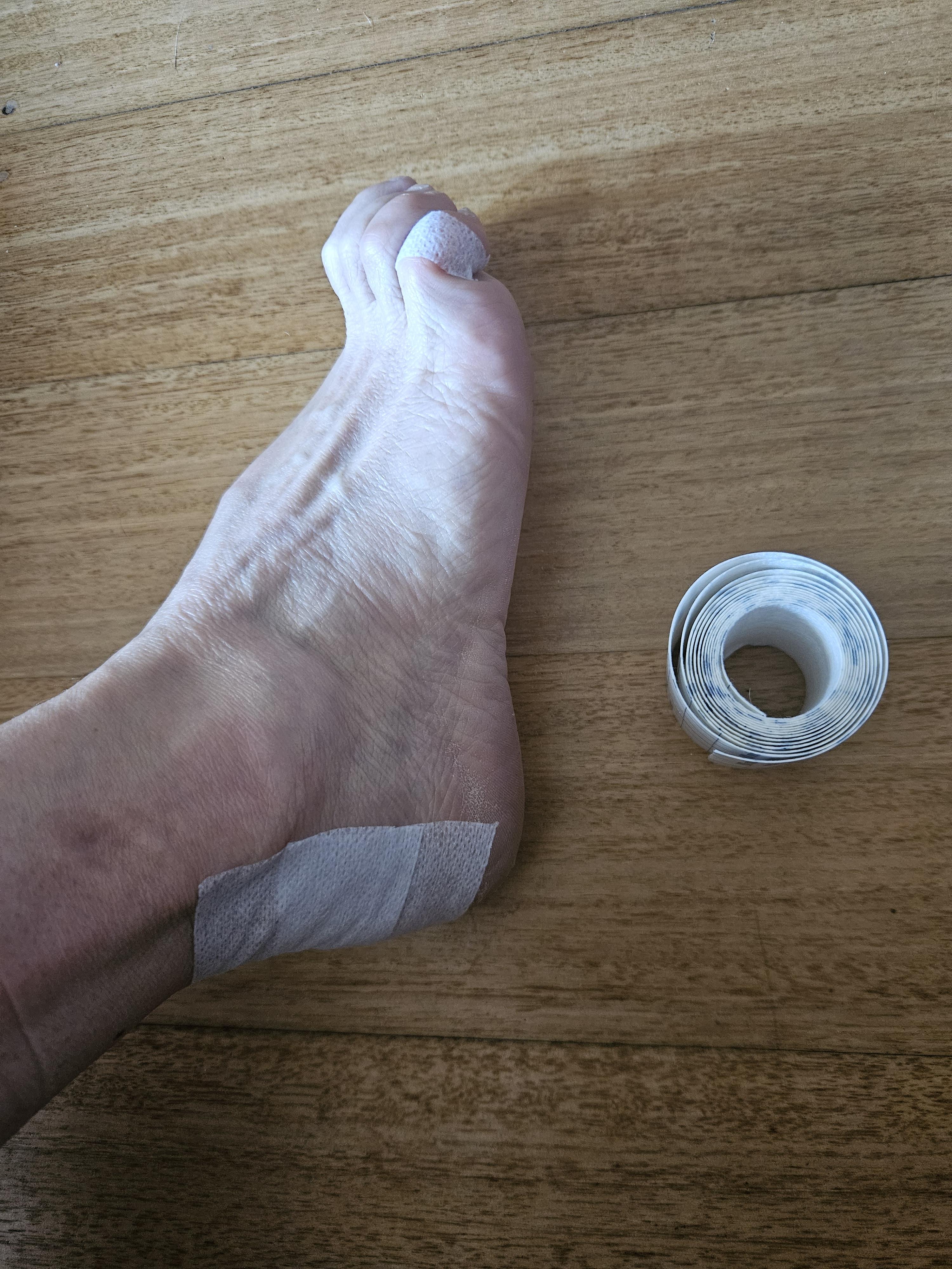 Taped feet example 